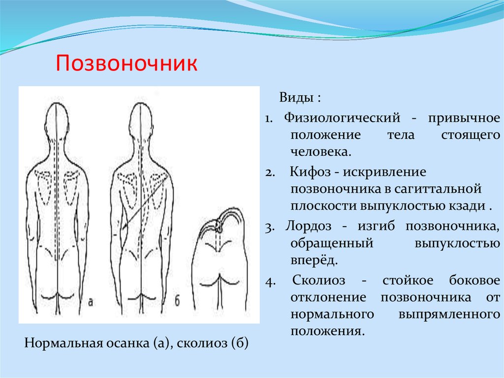 Искривление во фронтальной плоскости