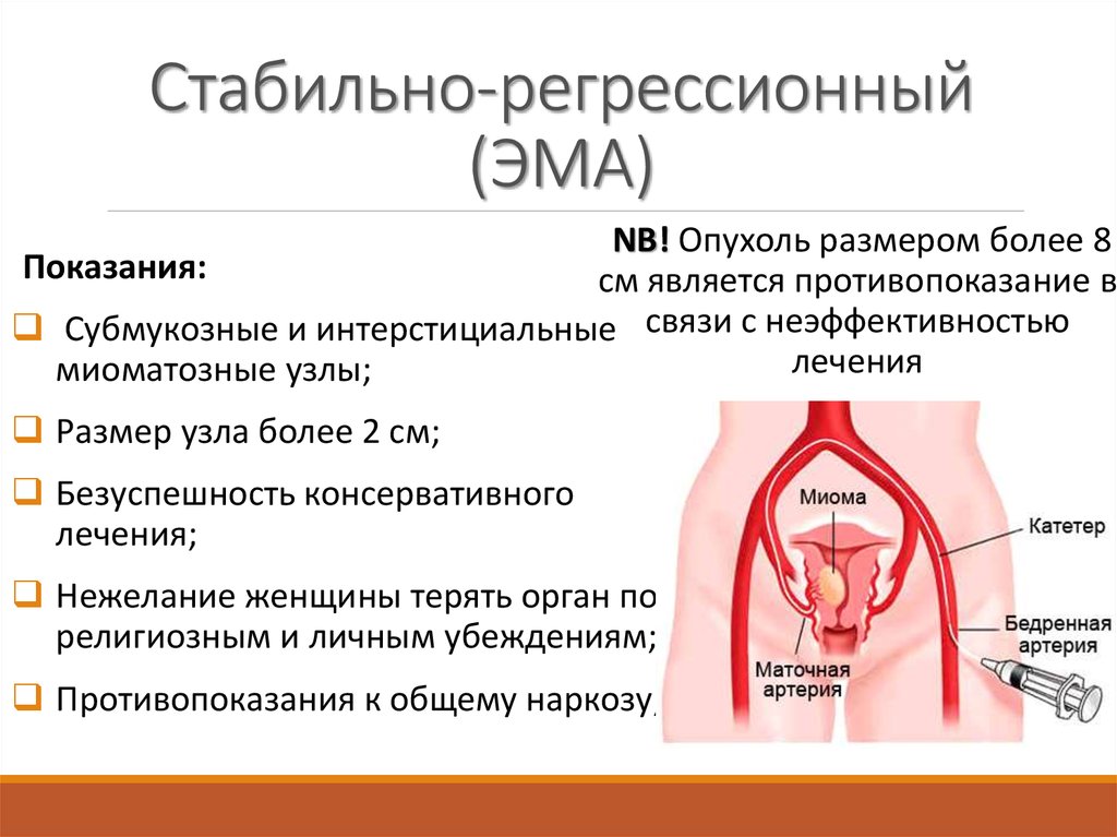 Эмболизация миомы. Эмболизация миомы матки показания. Эмболизация маточных артерий показания. Эма эмболизация показания. Эмболизация маточных артерий при миоме матки.