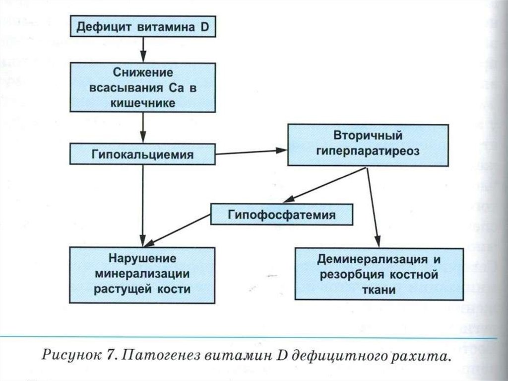 Механизм развития рахита схема