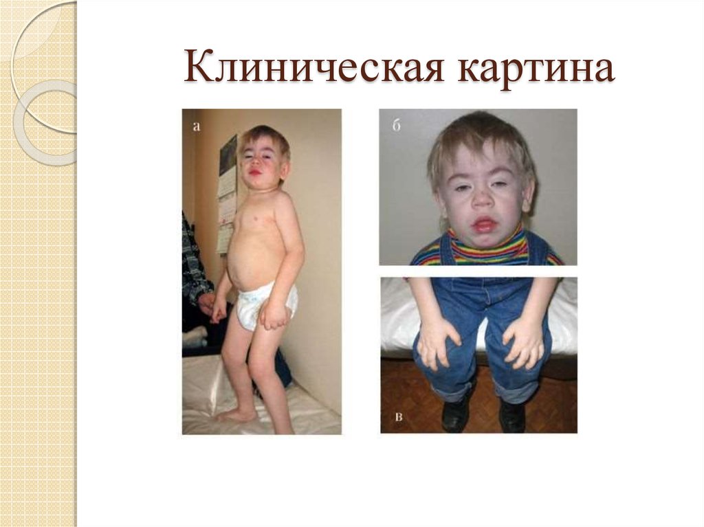 Клиническая картина