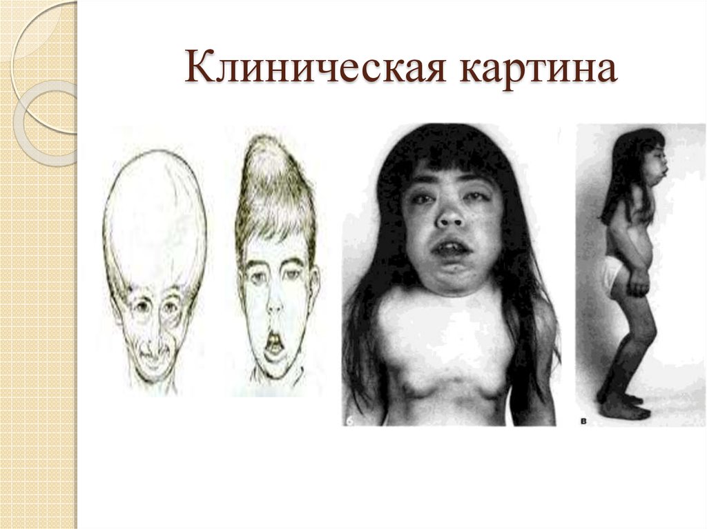 Клиническая картина