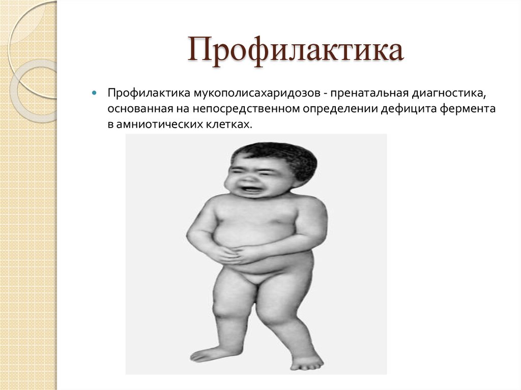 Профилактика