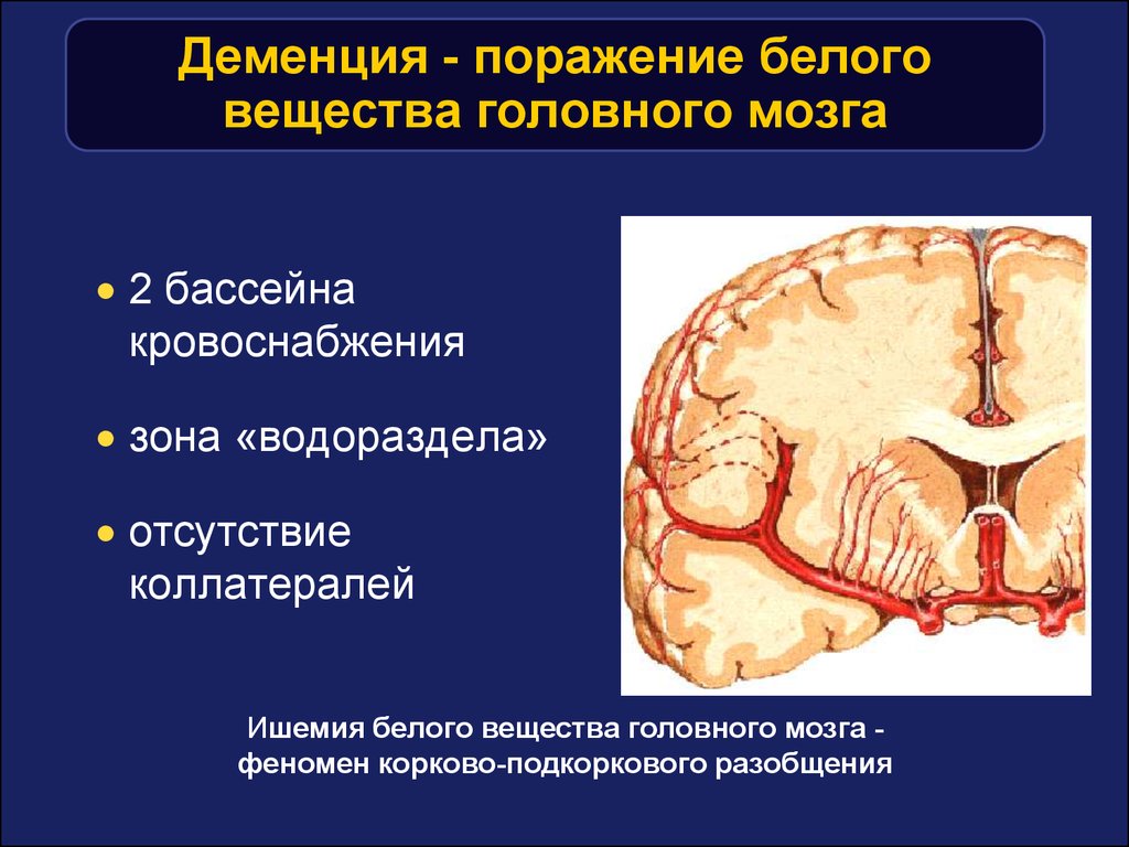 Поражение головного мозга. Поражение вещества головного мозга. Поражение белого вещества головного. Поражение головного мозга симптомы. Белое вещество головного мозга.