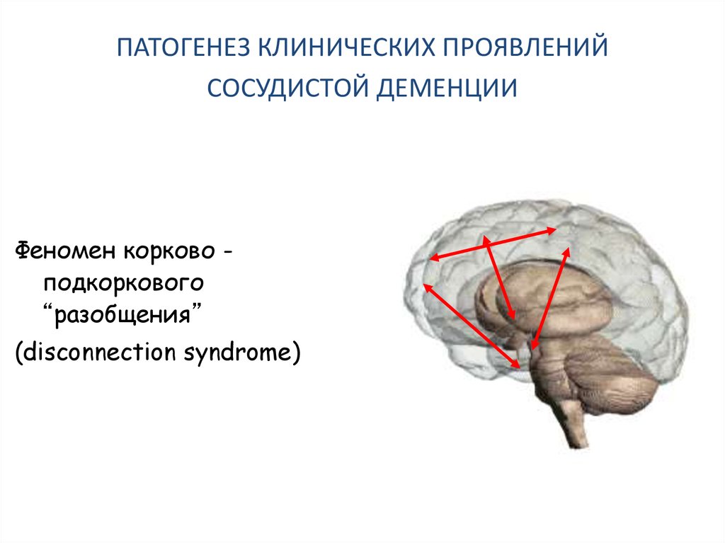 Корковая и подкорковая деменция. Клинические проявления сосудистой деменции. Сосудистая деменция этиология и патогенез.