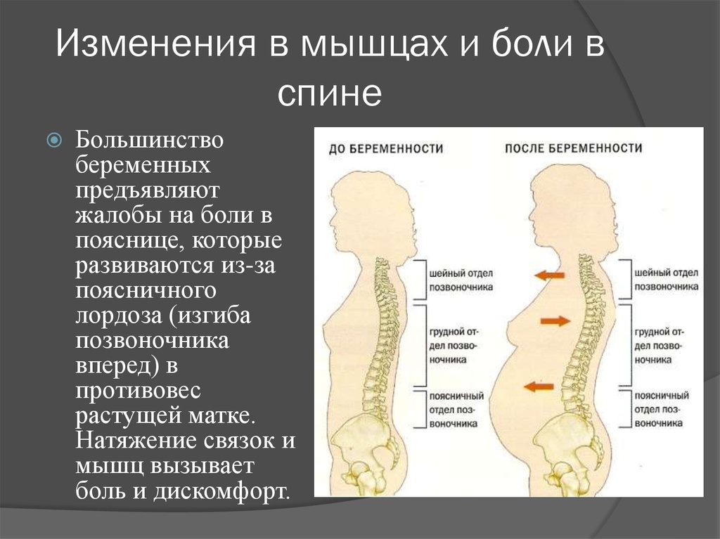 Болит спина в третьем триместре. Позвоночник у беременных. Изменения позвоночника у беременных. Изменение позвоночника при беременности. Лордоз.