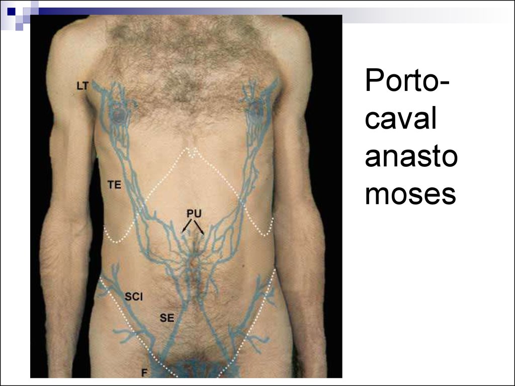 Венозный рисунок на груди