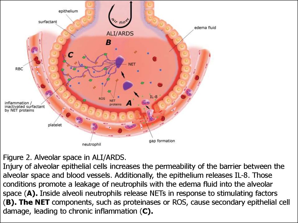 Net response. Alveolar Cells. Быстропрогрессирующий гломерулонефрит. Ali/Ards,. Subcapsular epithelium (Blood-Thymus Barrier).