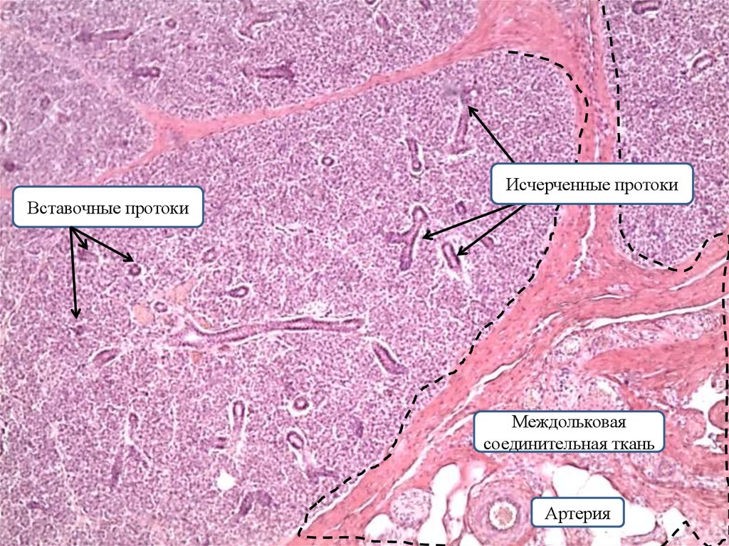 Железы гистология. Выводной проток околоушной слюнной железы гистология. Поджелудочная слюнная железа гистология. Проток околоушной железы гистология. Выводной проток околоушной железы гистология.