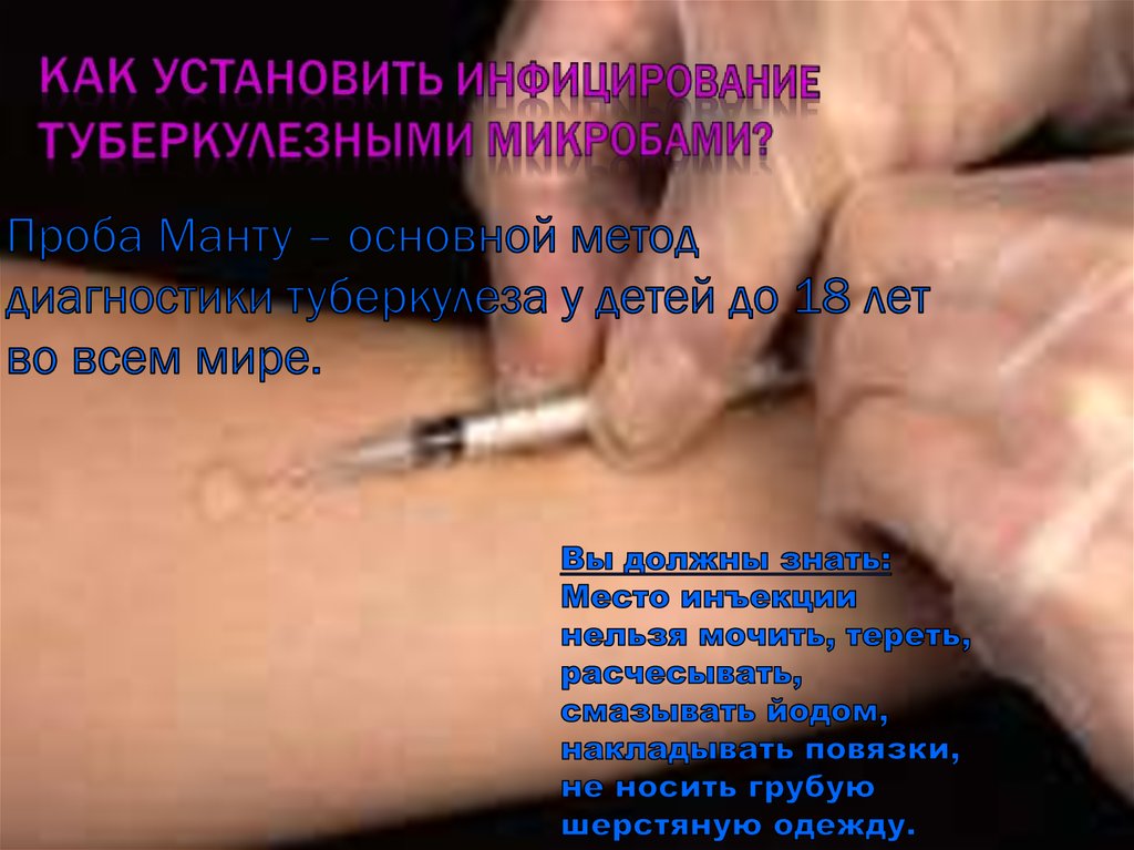Как установить инфицирование туберкулезными микробами?