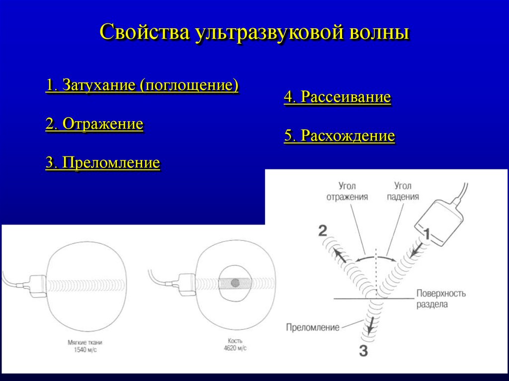 Отсутствие изображения за объектом вследствие затухания ультразвуковых волн называется