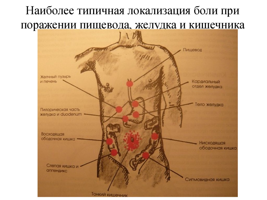 Причины колет тело. Локализация боли в животе. Локализация боли в животе в картинках. Локализация болей в левом боку. Боль в желудке локализация.