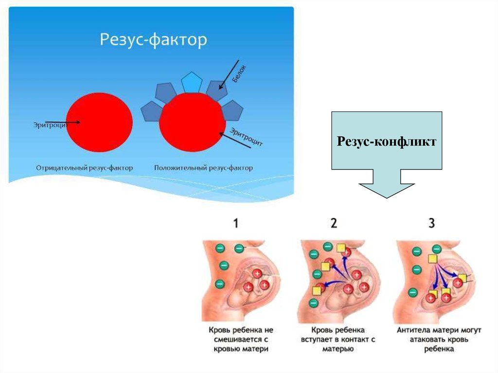 Фактор матери. Группа крови по резус фактору антитело. Резус отрицательный конфликт. Схема резус конфликт при беременности. Резус конфликт при переливании крови.