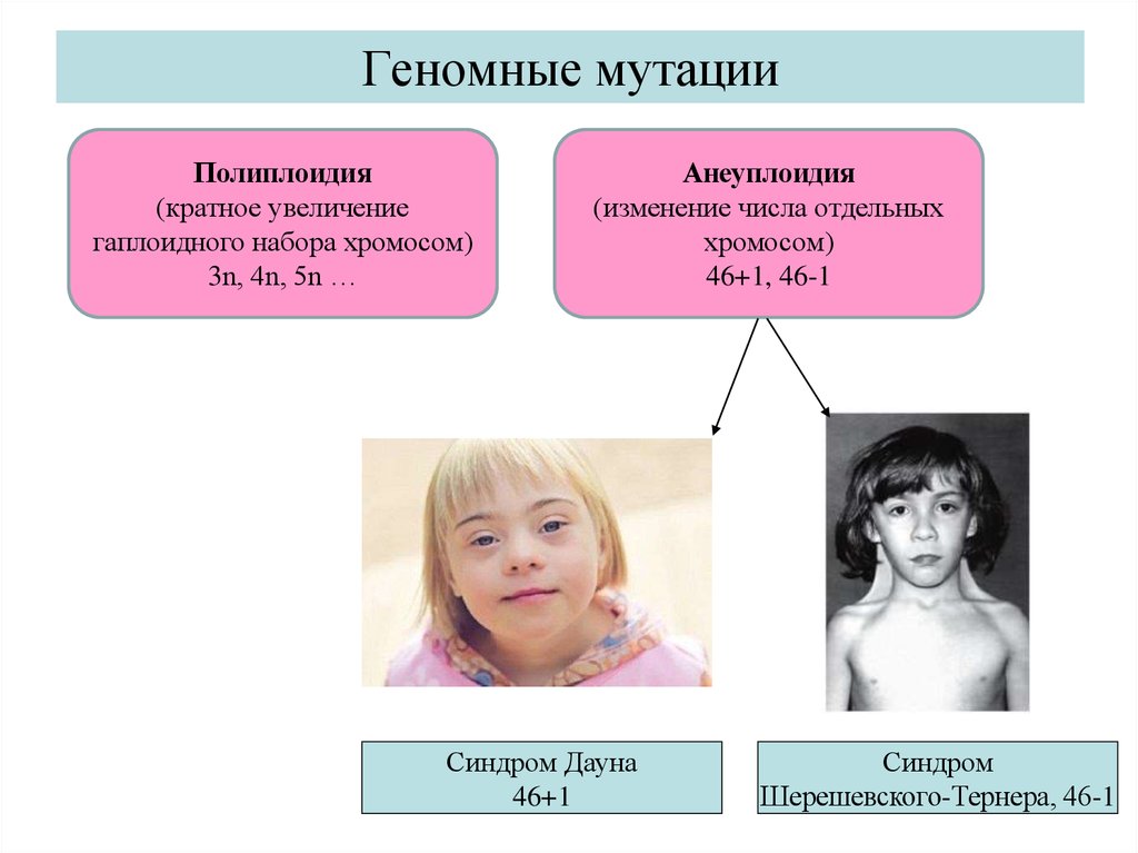 Хромосомные заболевания дауна. Геномные мутации аллополиплоидия. Синдром Дауна анэуплоидия. Гетероплоидия анеуплоидия. Хромосомные болезни, полиплоидии, анеуплоидии.