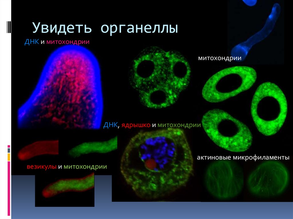 ДНК органелл. Органеллы в которых есть клеточный геном ДНК. Функции ядрышка в клетке. Микрофил биология.