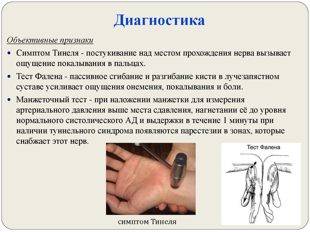 Карпо-карпальный синдром (тонельный синдром) - online presentation