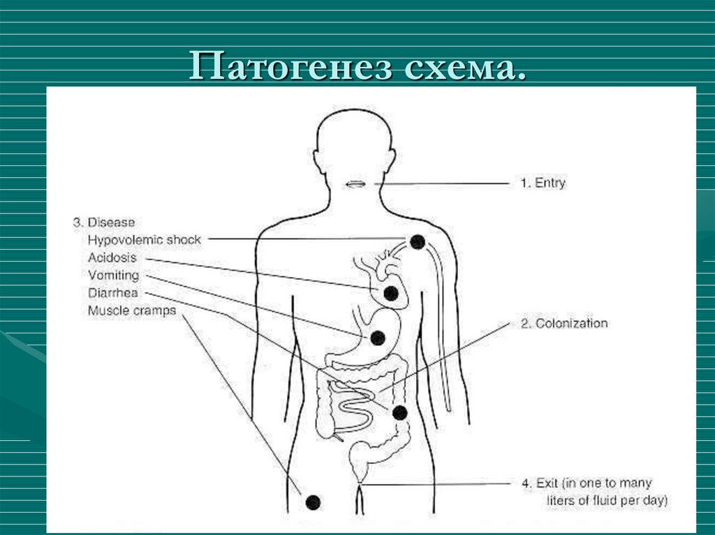 Схема патогенеза холеры