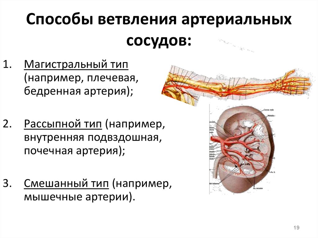 Магистральные сосуды это. Рассыпной Тип ветвления артерий. Магистральный Тип ветвления сосудов. Сосуды аорты дихотомического типа. Магистральный Тип ветвления кровеносных сосудов.