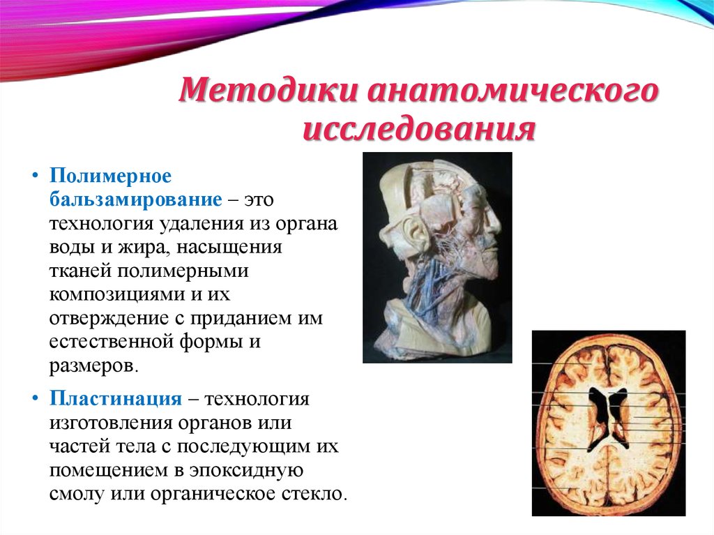 3 анатомических метода. Методы анатомического ислед. Методики анатомического иследоаа. Современные методы анатомии. Методы изучения анатомии.