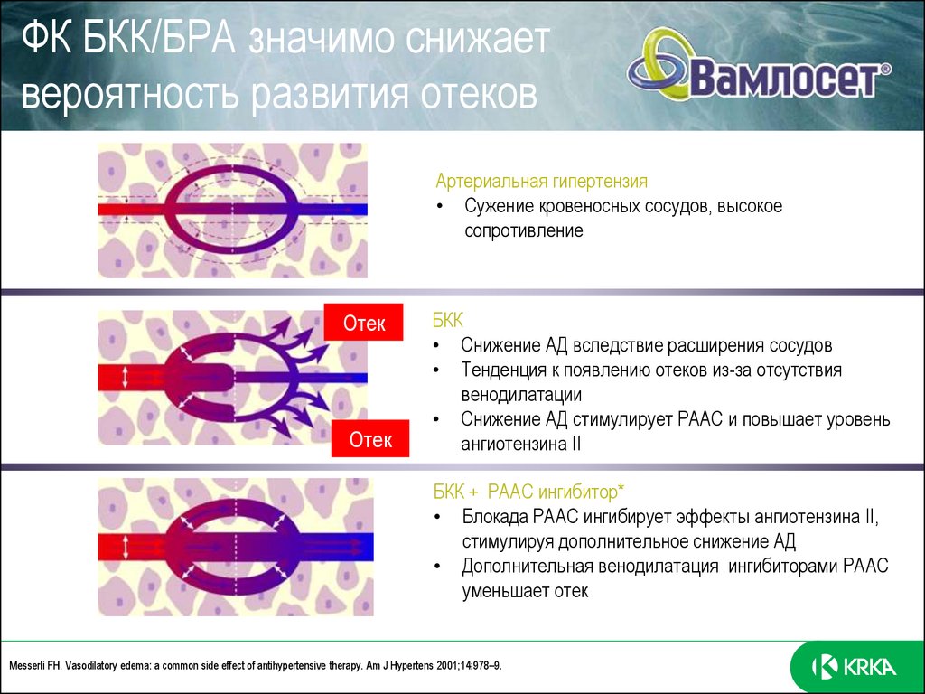 Вамлосет Подагра