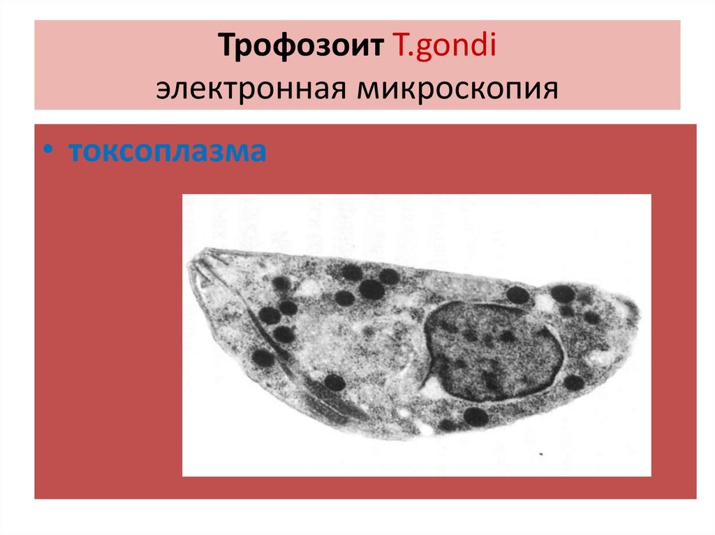 Токсоплазма рисунок с подписями