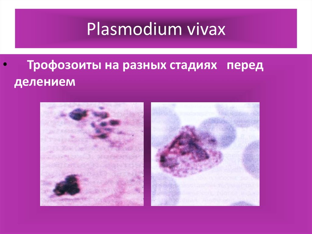 Плазмодий вивакс. Plasmodium Vivax периоды лихорадки. Плазмодии Вивакс.описание трофазоита. Трофозоиты.