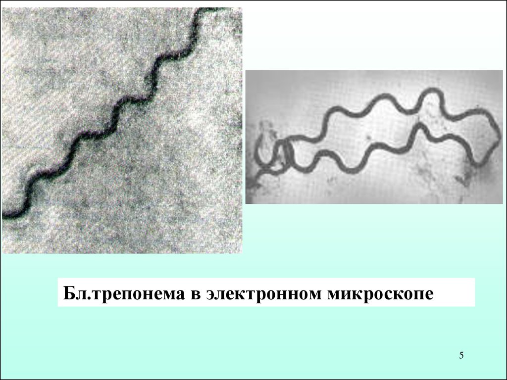 Бледная трепонема treponema pallidum. Бледная трепонема микроскоп. Бледная трепонема микробиология. Трепонема паллидум морфология. Формы трепонемы паллидум.