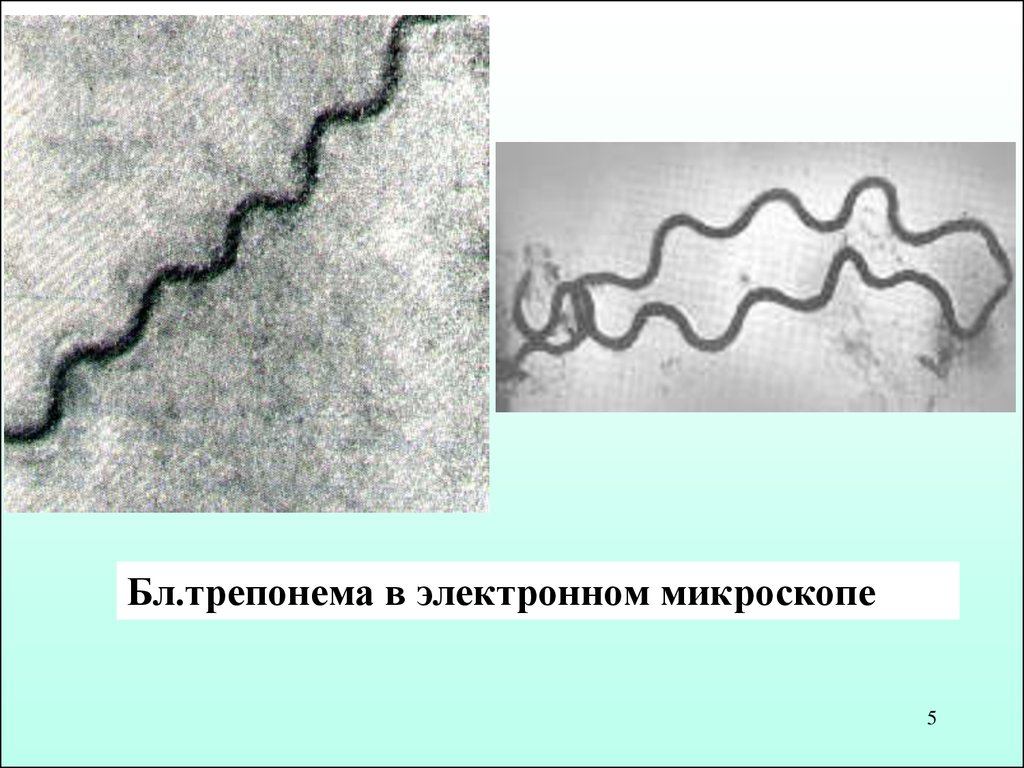 Бледная спирохета