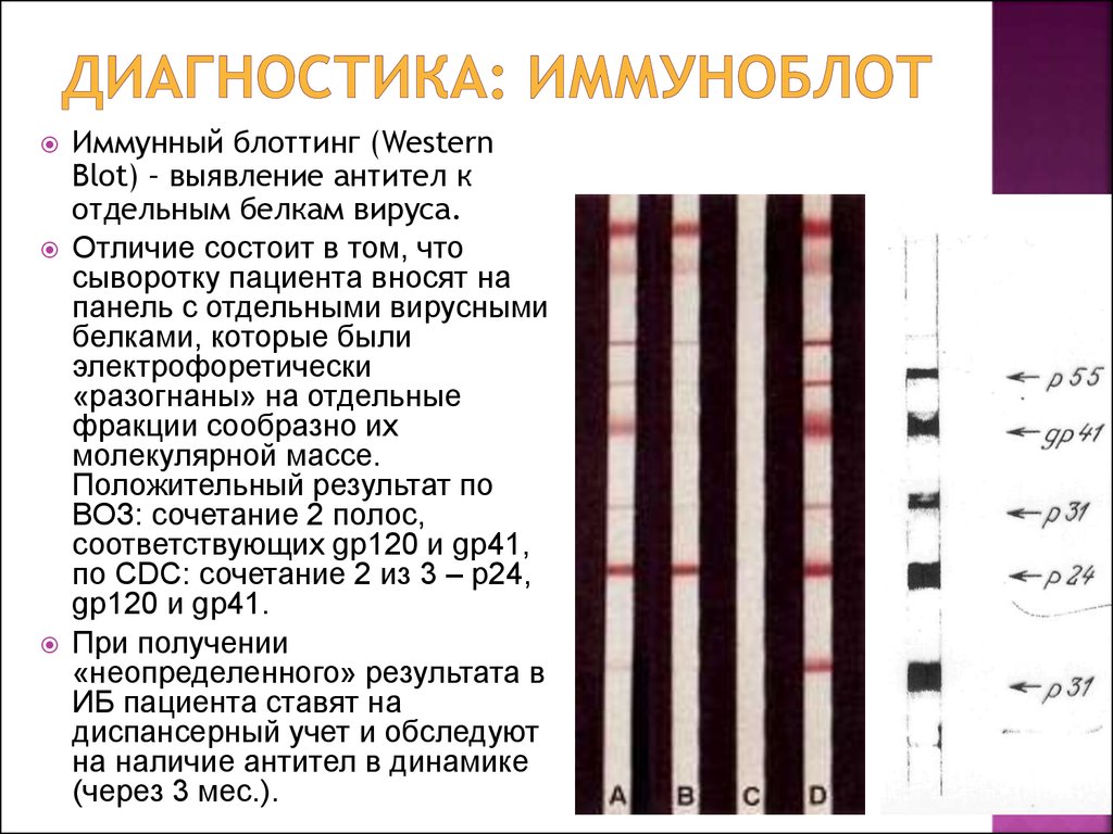 На изображении представлены результаты вестерн блоттинга. Иммуноблоттинг для диагностики ВИЧ инфекции. -Иммуноблот (иммунный блоттинг).. Иммуноблот на ВИЧ анализ. Метод иммунного блоттинга при ВИЧ.