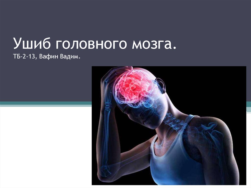 Сотрясение 2. Травмы головного мозга ушиб. Ушиб мозга легкой степени.