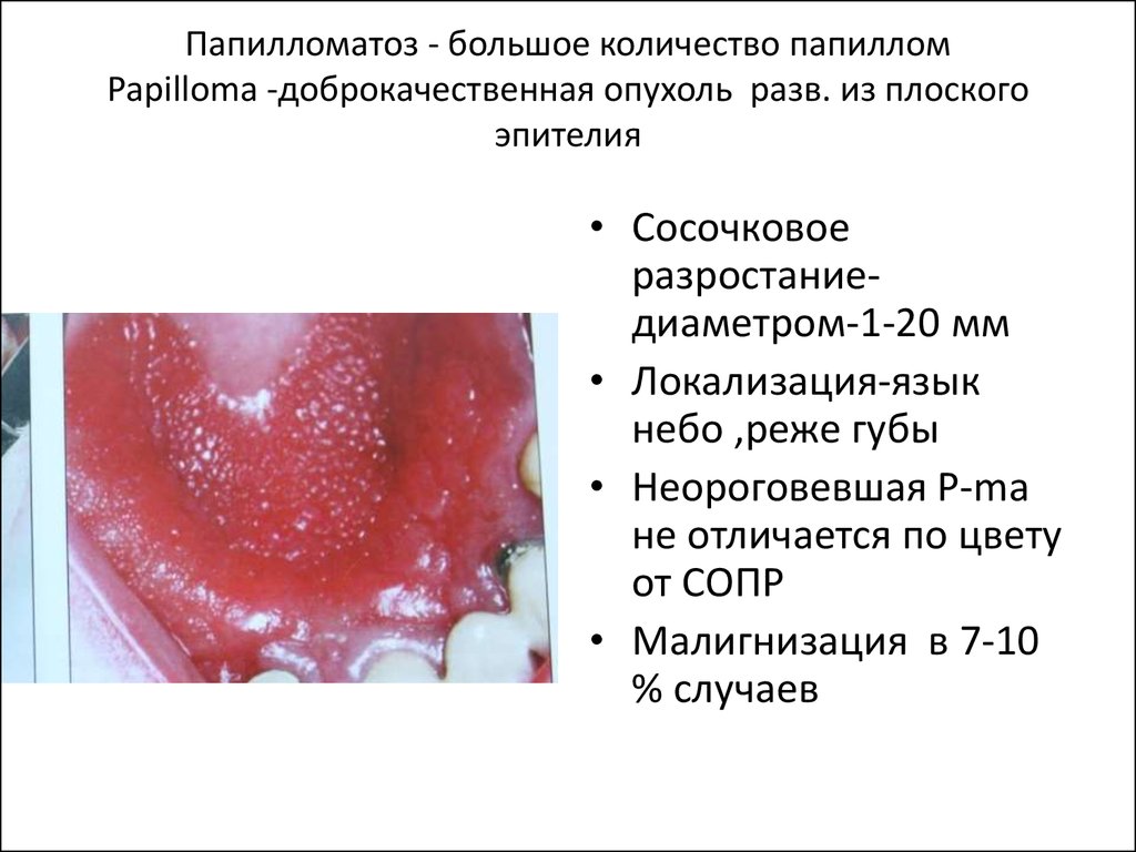 Папилломатоз карциноидный готтрона фото