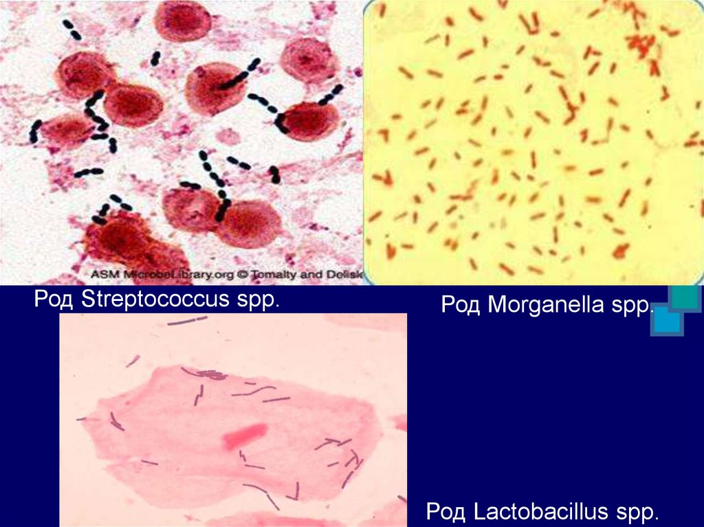 Lactobacillus spp у мужчин