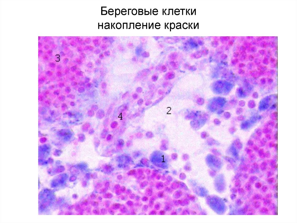 Клетки накопления. Срез лимфатического узла береговые клетки. Клетки лимфоузла гистология. Ретикулоэндотелиальные клетки лимфоузла. Накопление краски в лимфатическом узле.