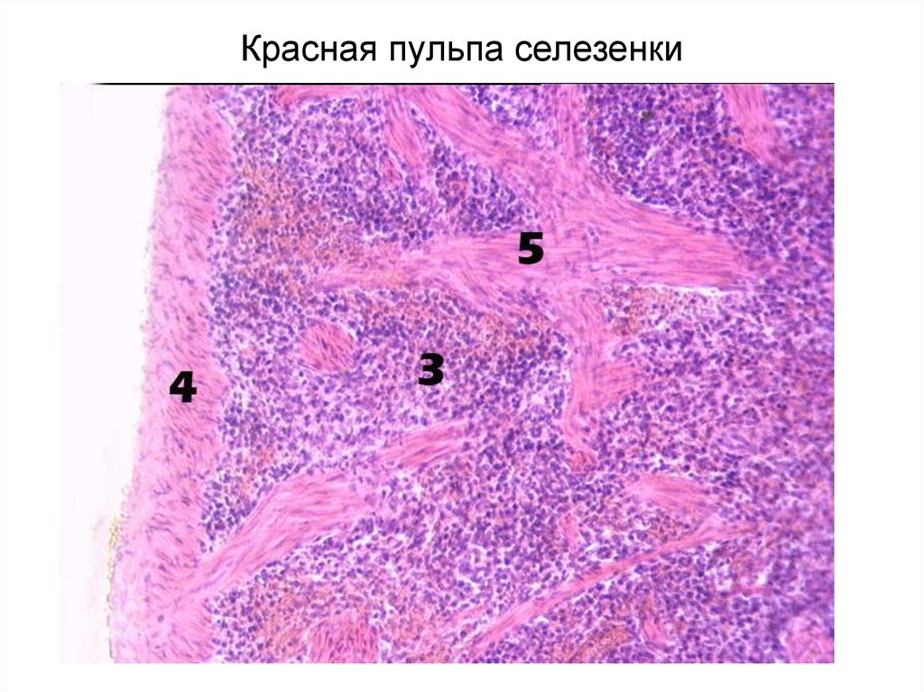 Селезенка препарат рисунок