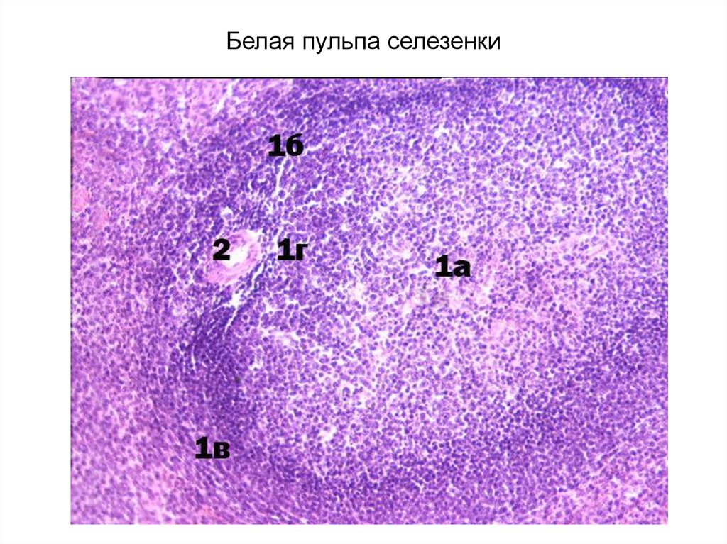 Красная пульпа селезенки. Белая пульпа селезенки гистология. Трабекулярная Вена селезенки. Белая и красная пульпа селезенки гистология. Красная пульпа селезенки гистология.