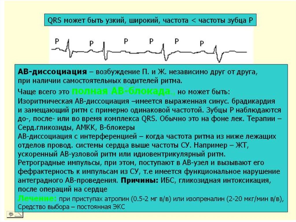 Узловой ритм сердца возникает когда роль водителя ритма берет на себя