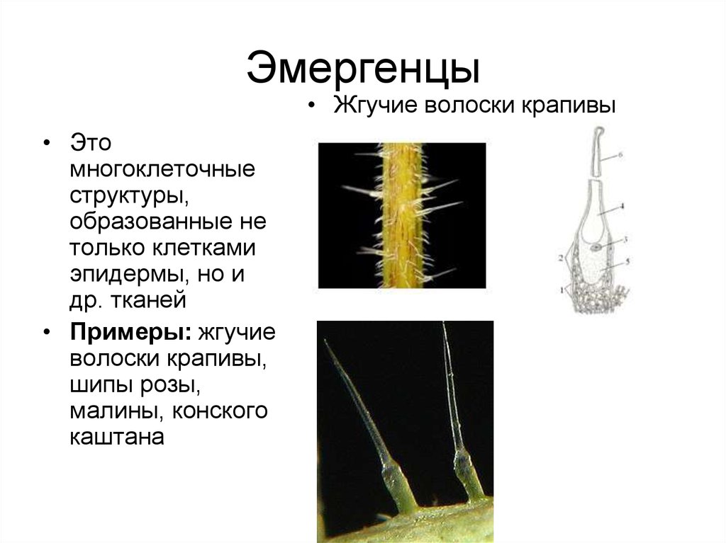 Какую функцию выполняют волоски у растений. Эмергенцы крапивы. Эмергенцы крапивы под микроскопом. Строение эмергенцев крапивы двудомной. Эмергенцы это ботаника.