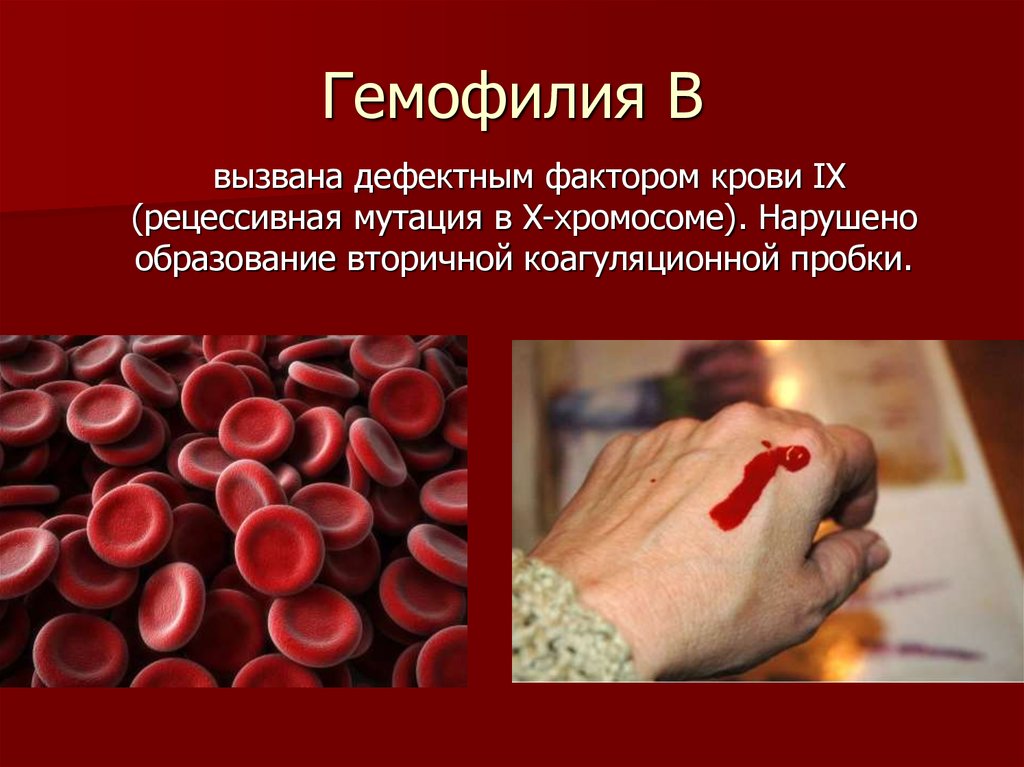 Какие признаки заболевание крови