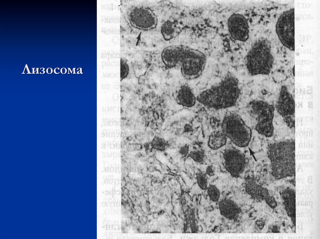 Лизосома днк. Лизосома электронная микрофотография. Лизосомы строение под микроскопом. Электронограмма лизосом. Лизосомы под электронным микроскопом.