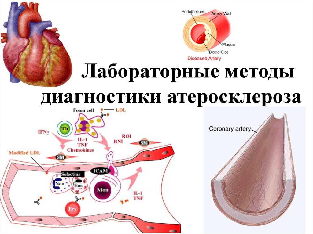 Атеросклероз обследование. Атеросклерозом лабораторные и инструментальные методы исследования. Лабораторные методы исследования при атеросклерозе. Лабораторная и инструментальная диагностика атеросклероза. Атеросклероз план обследования.