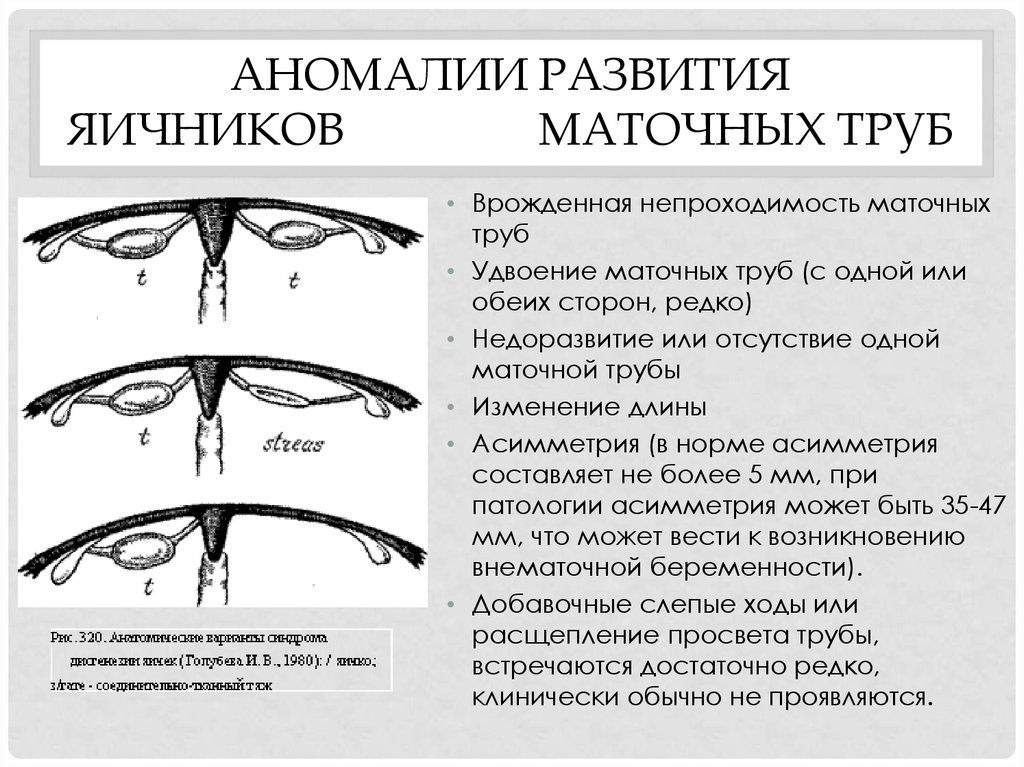 Аномалий развития женских