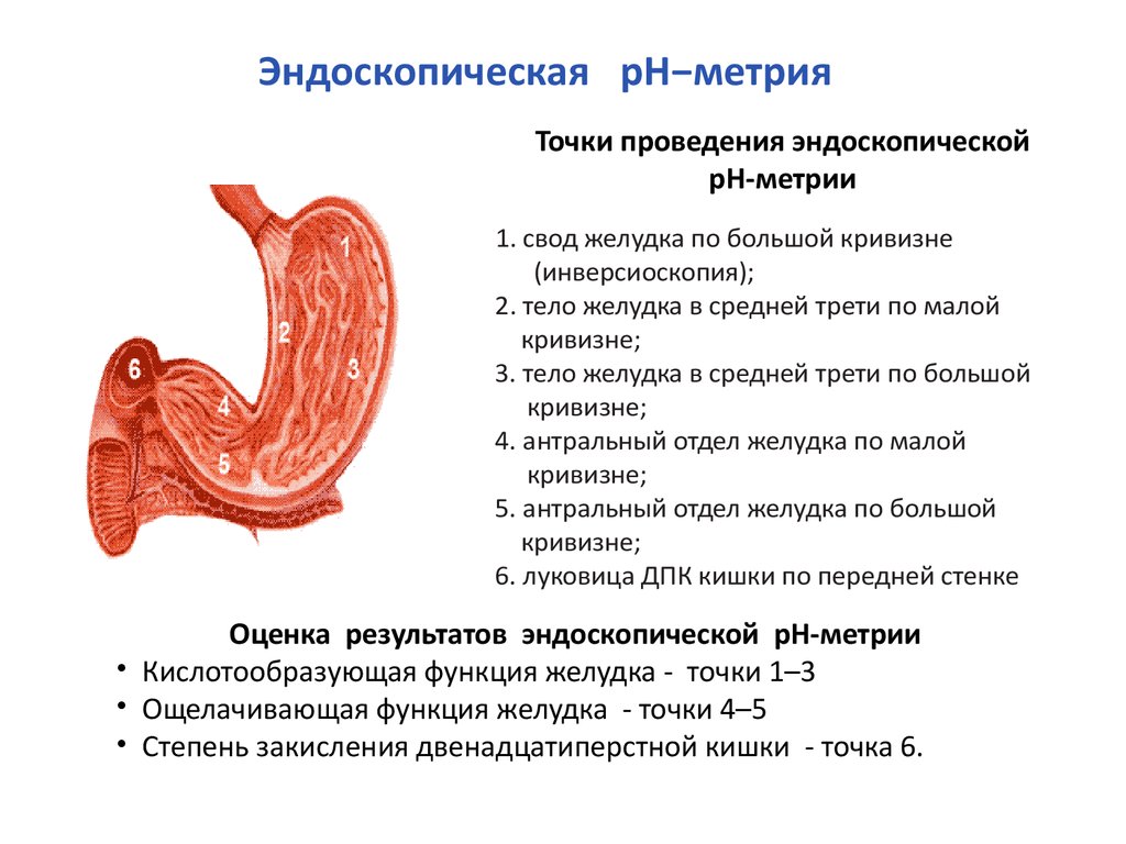 Кислотность пищевода. РН-метрия (исследование кислотообразующей функции желудка). РН-метрия желудка заключение. РН метрия при язвенной болезни желудка. Эндоскопическая внутрижелудочная РН-метрия.