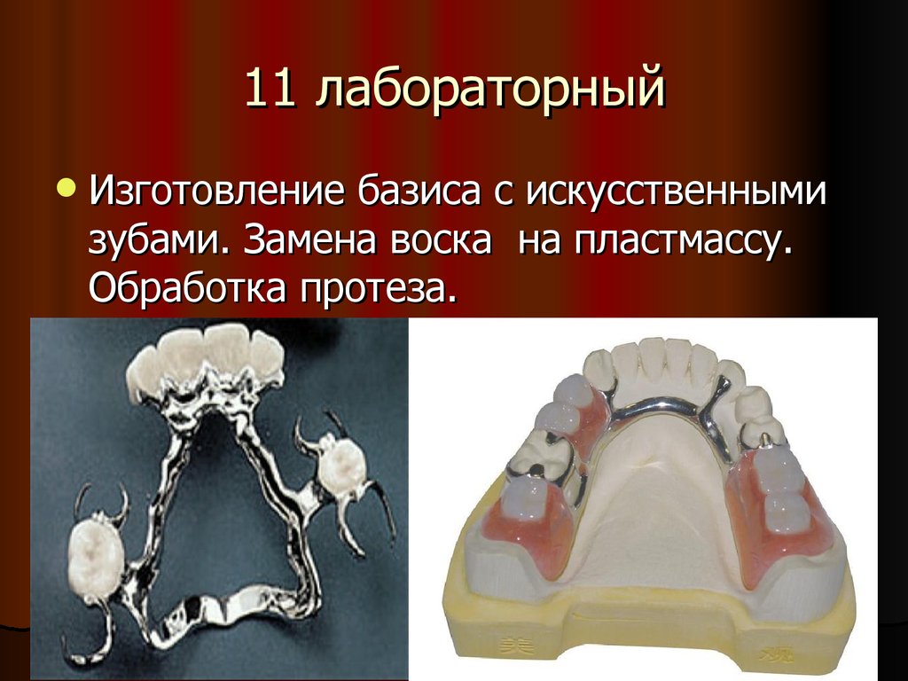 Клинико лабораторные этапы изготовления бюгельных протезов презентация