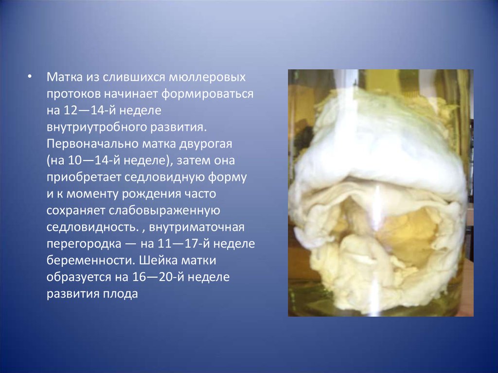 Люди гермафродиты фото половых органов