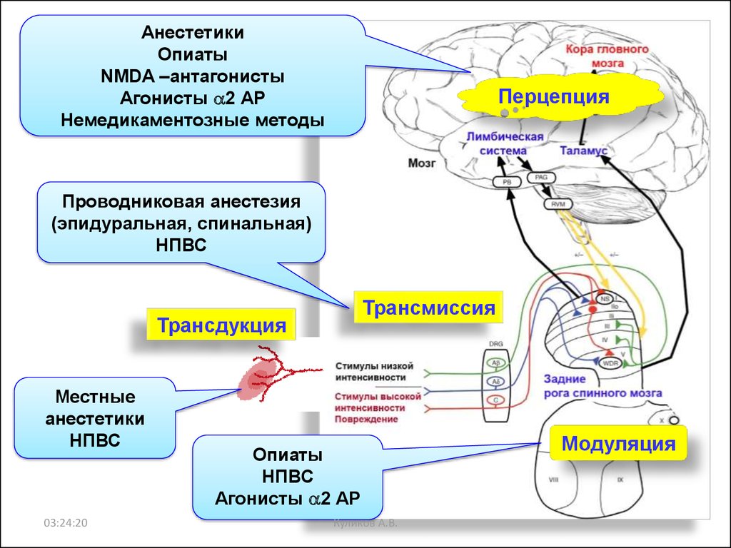 Мультимодальная анестезия презентация