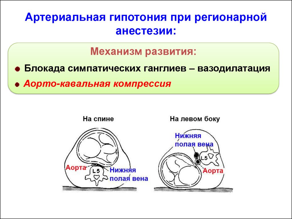 Нейроаксиальная анестезия