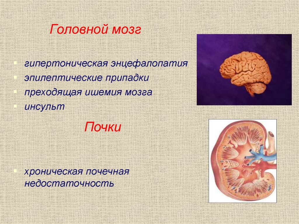 Почках и в головном мозге. Хроническая ишемия головного мозга. Заболевания почек и головного мозга.