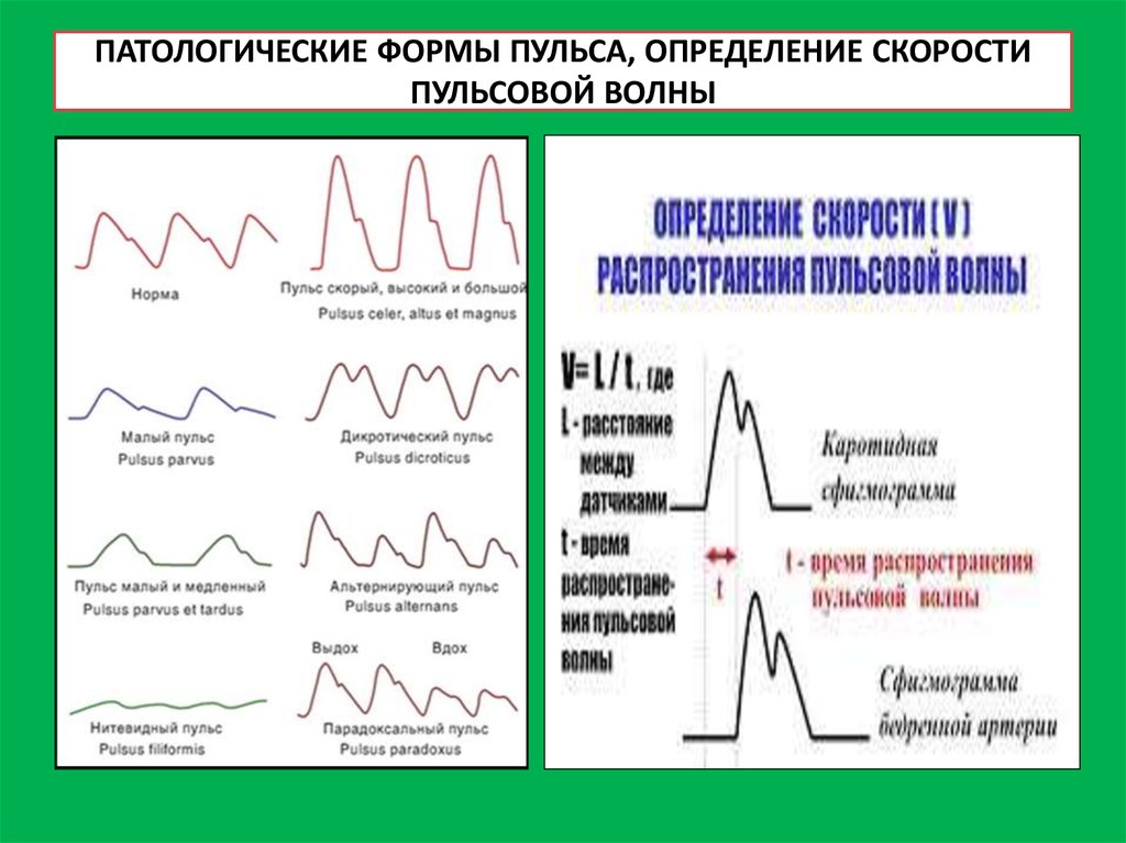 Пульс характеризуют. Пульсоксиметр график пульсовой волны. Форма пульсовой волны. Патологические формы пульсовой волны. Патологические формы пульса.
