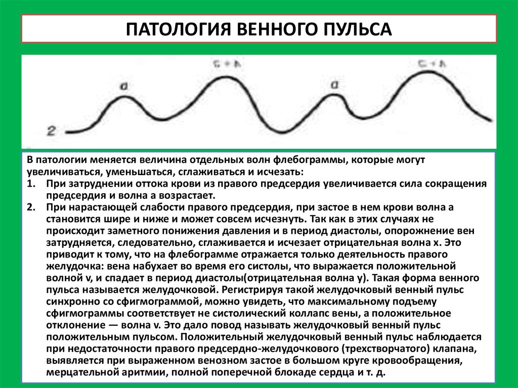 Виды пульса. Патологический пульс. Патологические формы пульса. Пульс виды пульса. Патологические типы пульса.