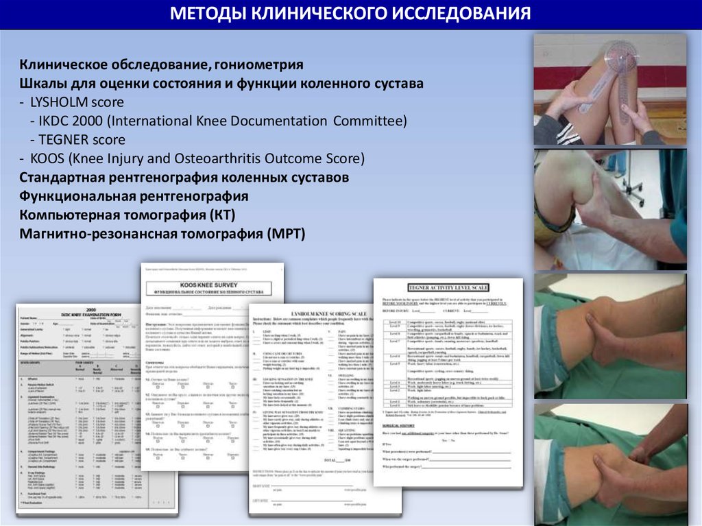 Обследование суставов. Оценка состояния суставов. Методы обследования в травматологии. Обследование суставов методики. Шкала оценки функции коленного сустава.