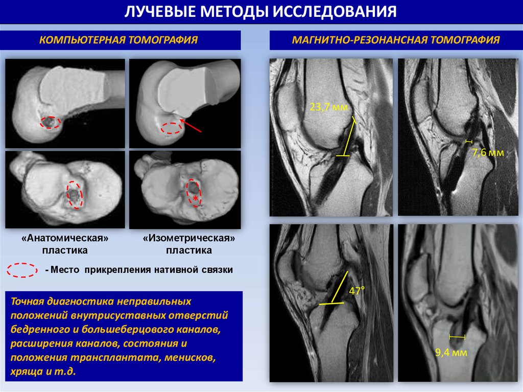 Методы обследования в травматологии и ортопедии презентация